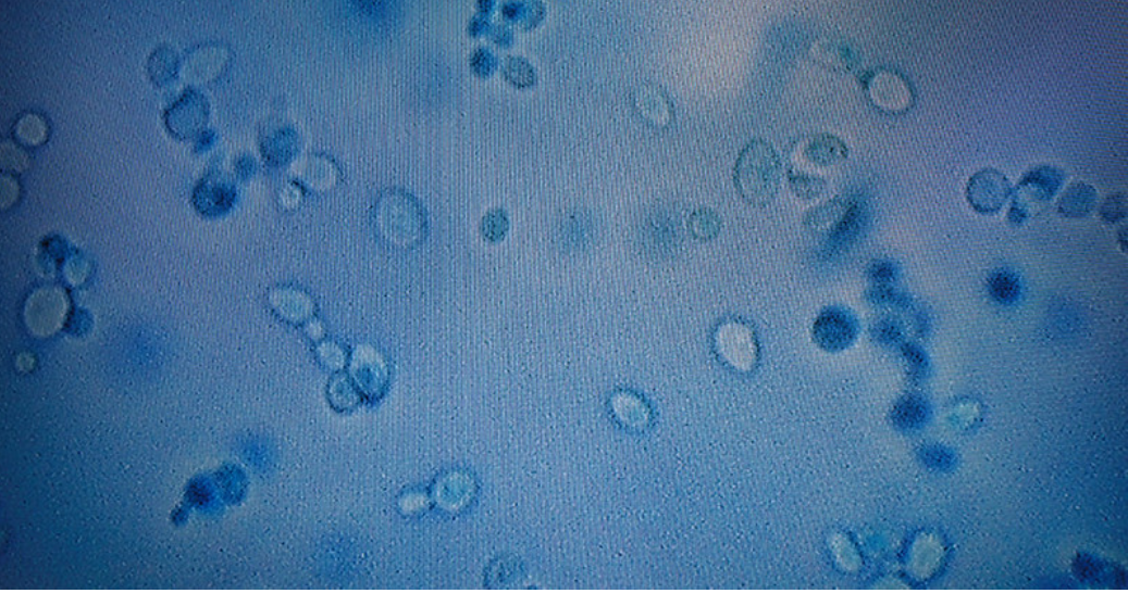 CDC warns of Candida auris, deadly fungus spreading in Florida